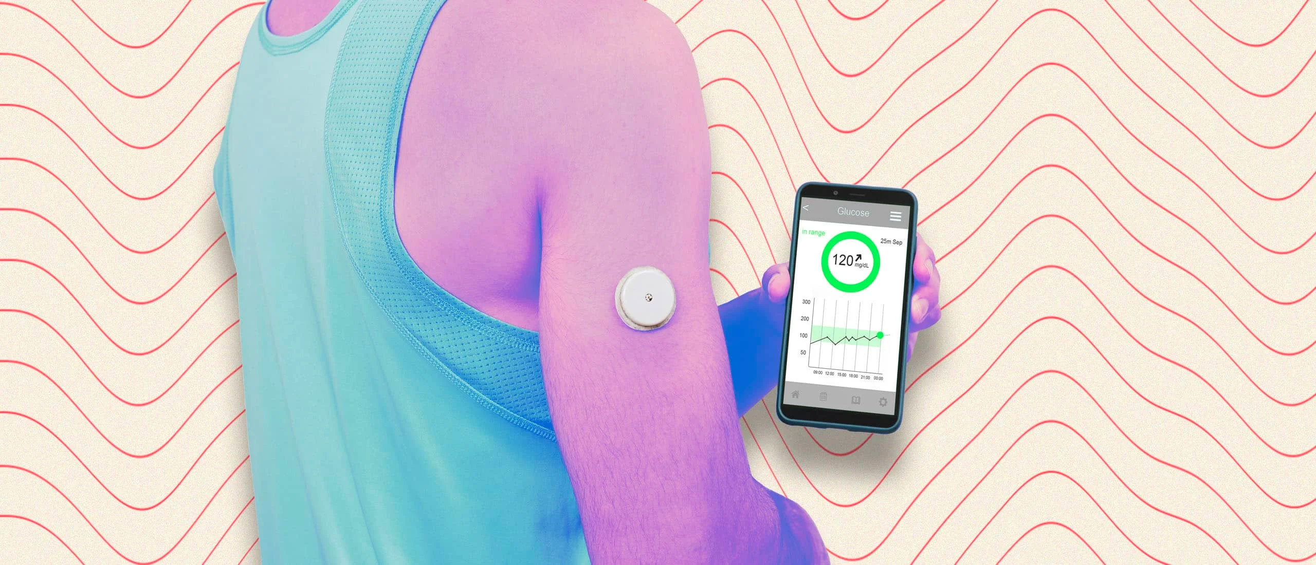 man wearing a continuous glucose monitor on his arm and holding his phone which shows his real time blood glucose level.