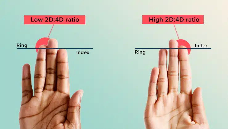 two hands on a turquoise background. One has a low 2D:4D ratio and one has a high ratio.